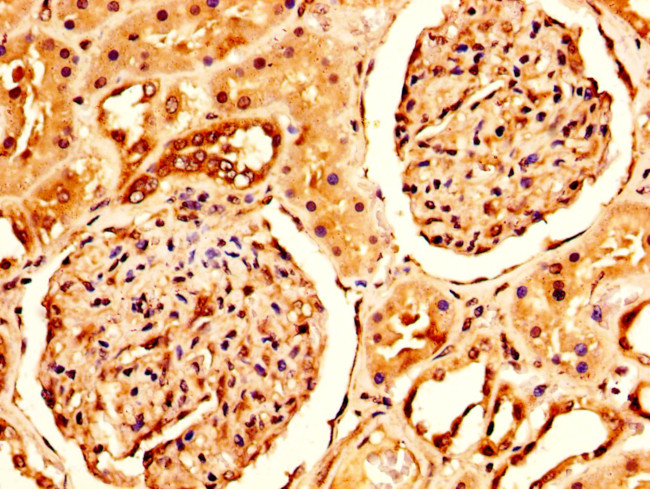 CRYAB Antibody in Immunohistochemistry (Paraffin) (IHC (P))