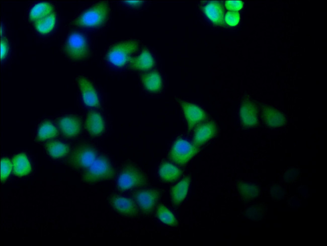 CAS Antibody in Immunocytochemistry (ICC/IF)