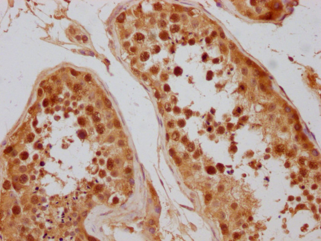 CAS Antibody in Immunohistochemistry (Paraffin) (IHC (P))