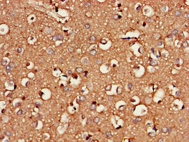 CSGALNACT2 Antibody in Immunohistochemistry (Paraffin) (IHC (P))