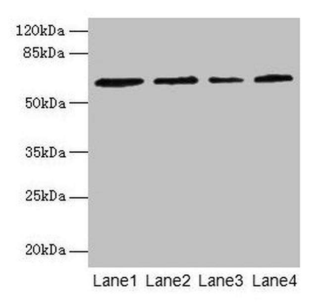 CSGALNACT2 Antibody in Western Blot (WB)