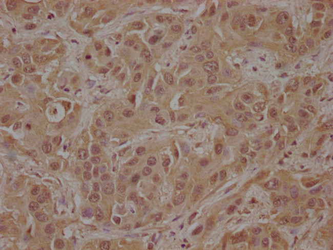 CSK Antibody in Immunohistochemistry (Paraffin) (IHC (P))