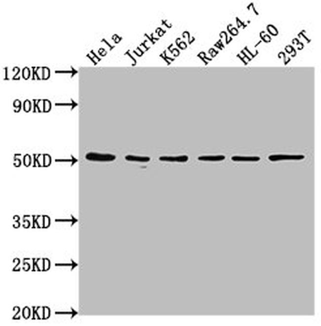 CSK Antibody in Western Blot (WB)