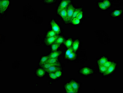 CK1 delta Antibody in Immunocytochemistry (ICC/IF)