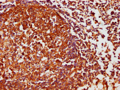 CK1 delta Antibody in Immunohistochemistry (Paraffin) (IHC (P))