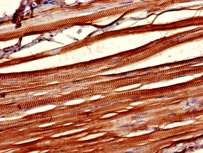 CK1 delta Antibody in Immunohistochemistry (Paraffin) (IHC (P))