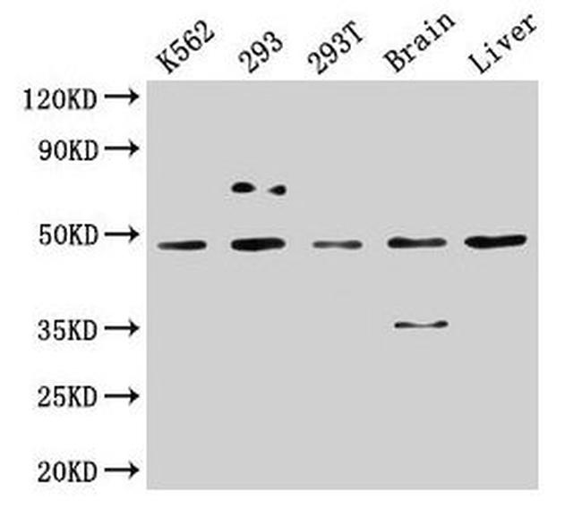 CK1 delta Antibody in Western Blot (WB)