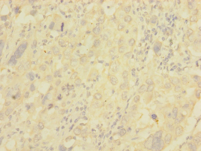 NG2 Antibody in Immunohistochemistry (Paraffin) (IHC (P))