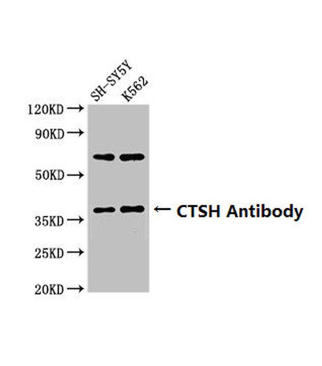 Cathepsin H Antibody in Western Blot (WB)