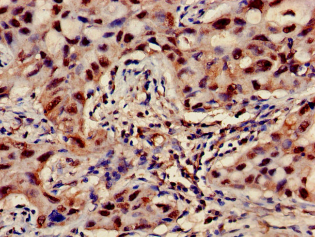 ATP5D Antibody in Immunohistochemistry (Paraffin) (IHC (P))