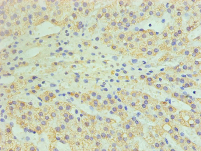 CYP11A1 Antibody in Immunohistochemistry (Paraffin) (IHC (P))