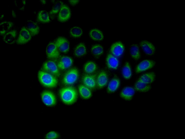 CYP17A1 Antibody in Immunocytochemistry (ICC/IF)