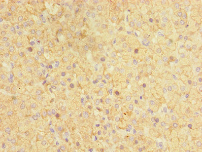 CYP17A1 Antibody in Immunohistochemistry (Paraffin) (IHC (P))