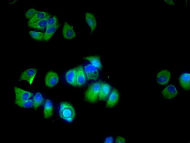 CYP17A1 Antibody in Immunocytochemistry (ICC/IF)