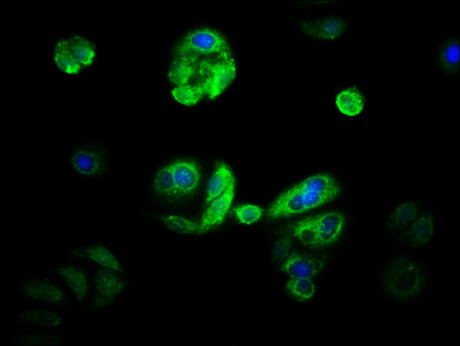 CYP21A2 Antibody in Immunocytochemistry (ICC/IF)