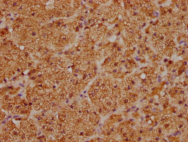 CYP21A2 Antibody in Immunohistochemistry (Paraffin) (IHC (P))