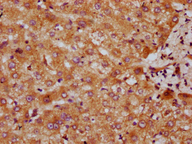 CYP7A1 Antibody in Immunohistochemistry (Paraffin) (IHC (P))