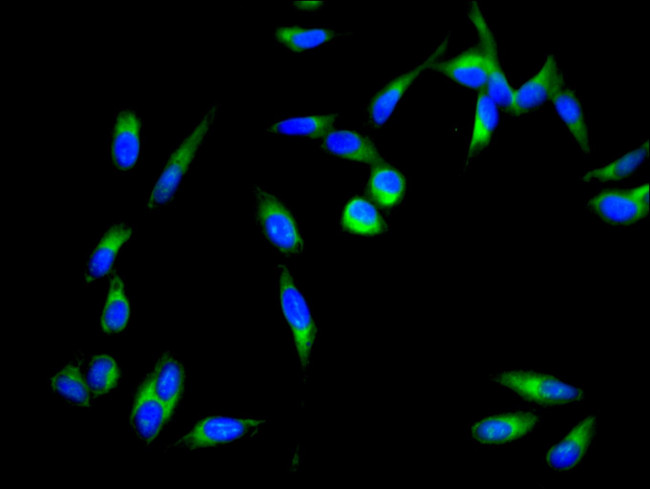 ZIPK Antibody in Immunocytochemistry (ICC/IF)