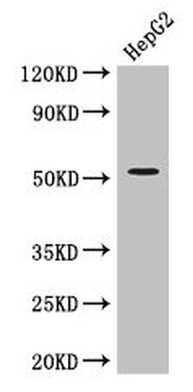 ZIPK Antibody in Western Blot (WB)