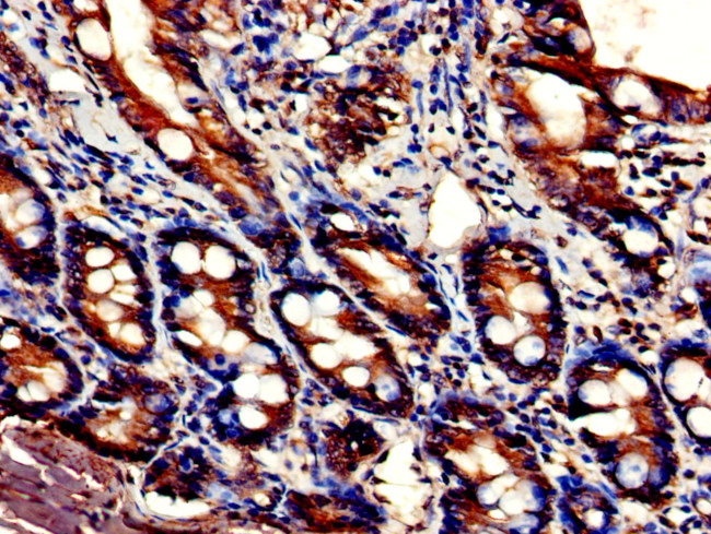 DDHD2 Antibody in Immunohistochemistry (Paraffin) (IHC (P))