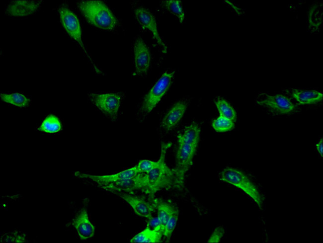 DDX6 Antibody in Immunocytochemistry (ICC/IF)