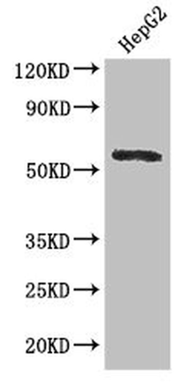 DDX6 Antibody in Western Blot (WB)