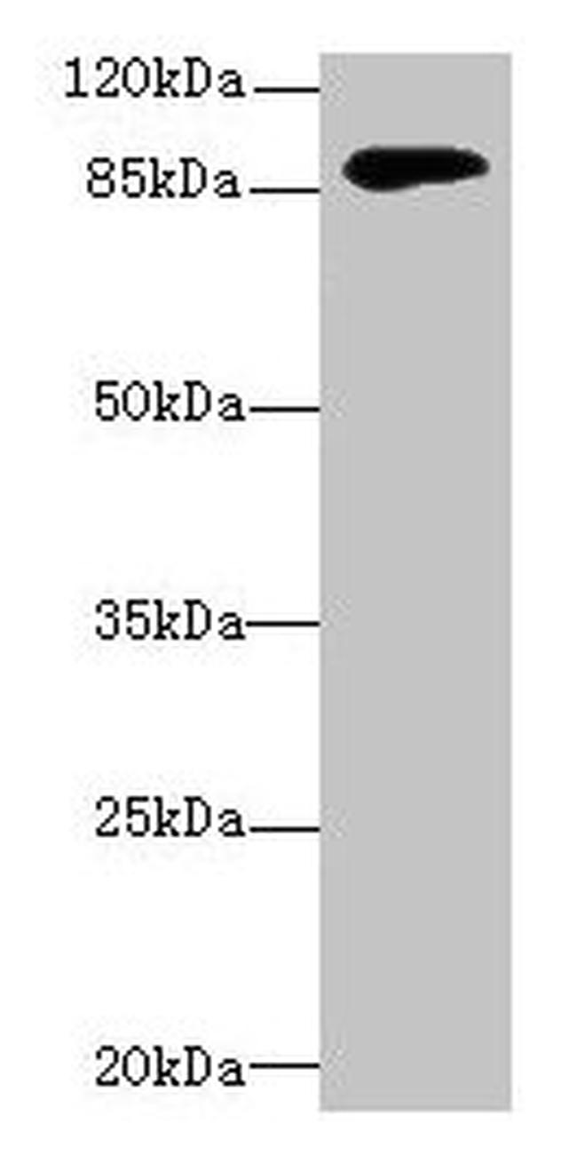 DGKG Antibody in Western Blot (WB)