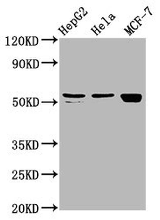 DHCR7 Antibody in Western Blot (WB)