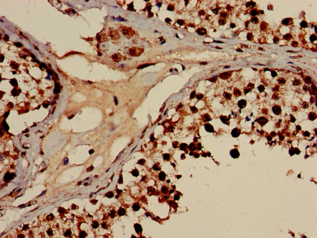 DHRS12 Antibody in Immunohistochemistry (Paraffin) (IHC (P))