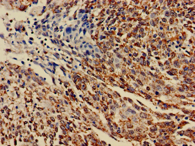 DHRS12 Antibody in Immunohistochemistry (Paraffin) (IHC (P))