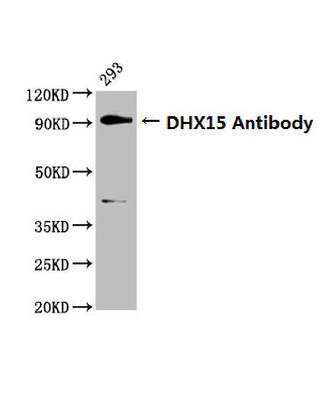 DHX15 Antibody in Western Blot (WB)