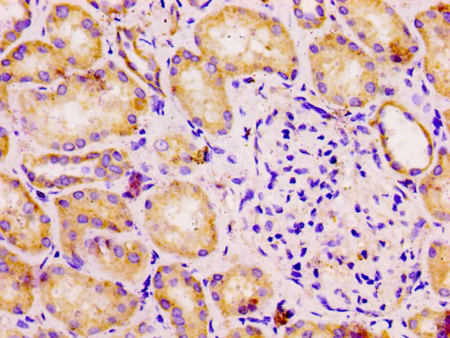 DLD Antibody in Immunohistochemistry (Paraffin) (IHC (P))