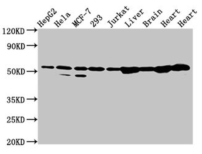 DLD Antibody in Western Blot (WB)