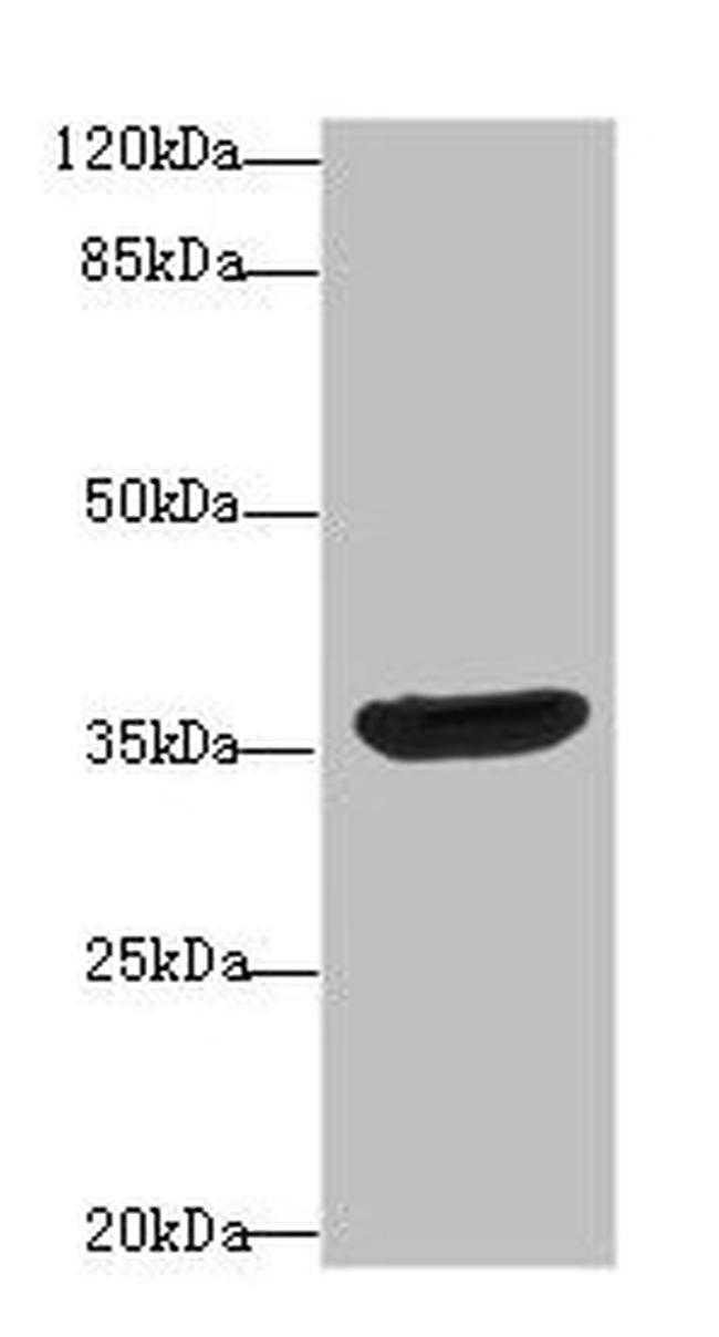 DNAJB2 Antibody in Western Blot (WB)