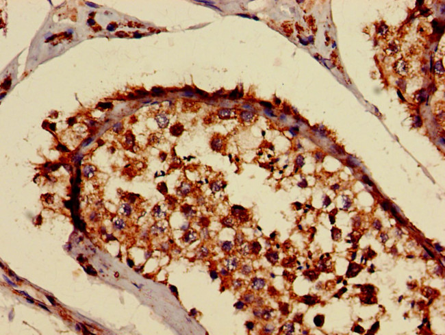 B4GALT3 Antibody in Immunohistochemistry (Paraffin) (IHC (P))