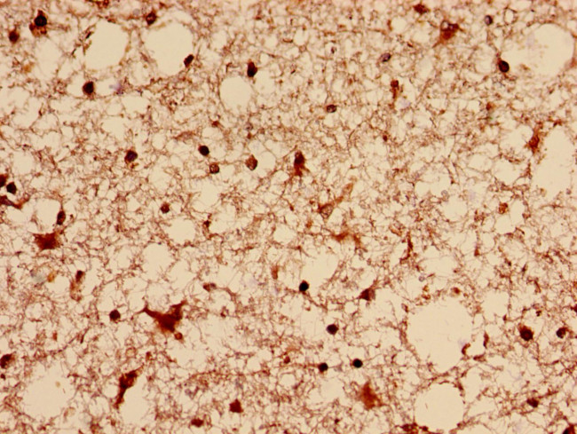 DNM1L Antibody in Immunohistochemistry (Paraffin) (IHC (P))