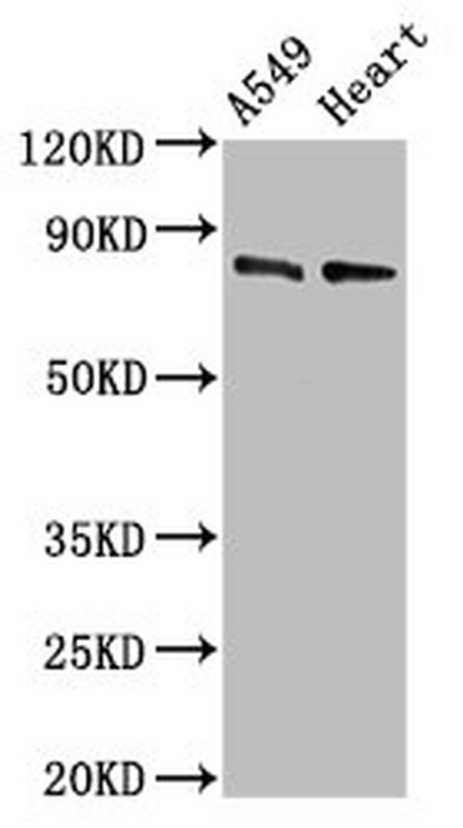 DNM1L Antibody in Western Blot (WB)