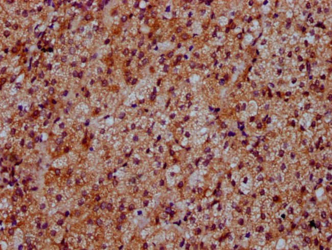 DYM Antibody in Immunohistochemistry (Paraffin) (IHC (P))