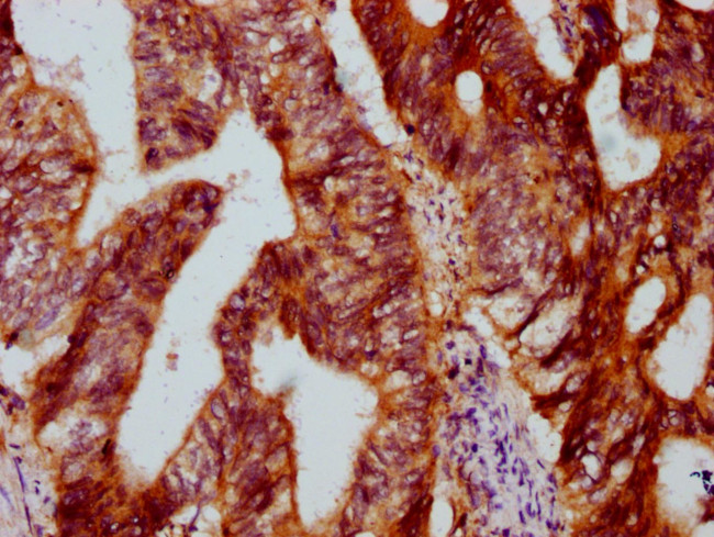 DYM Antibody in Immunohistochemistry (Paraffin) (IHC (P))