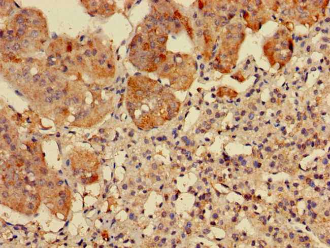 RPS5 Antibody in Immunohistochemistry (Paraffin) (IHC (P))