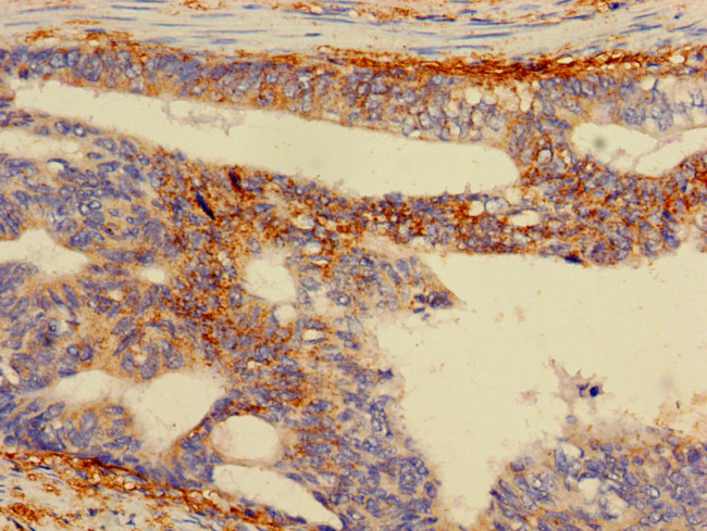 RPS5 Antibody in Immunohistochemistry (Paraffin) (IHC (P))