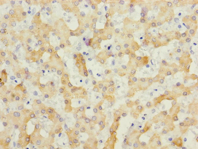 ECHS1 Antibody in Immunohistochemistry (Paraffin) (IHC (P))