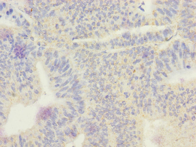 ECHS1 Antibody in Immunohistochemistry (Paraffin) (IHC (P))