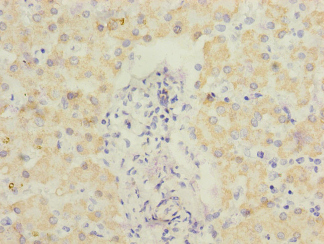 ECHS1 Antibody in Immunohistochemistry (Paraffin) (IHC (P))