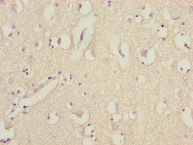 EEF1A2 Antibody in Immunohistochemistry (Paraffin) (IHC (P))