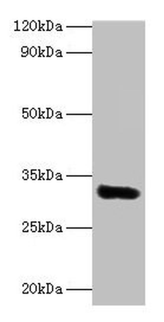 EEF1D Antibody in Western Blot (WB)