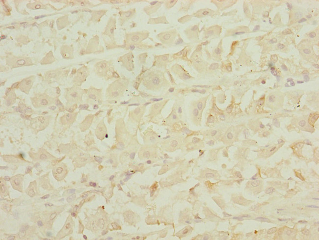 EEF1G Antibody in Immunohistochemistry (Paraffin) (IHC (P))