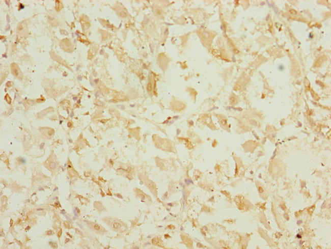 EEF1G Antibody in Immunohistochemistry (Paraffin) (IHC (P))