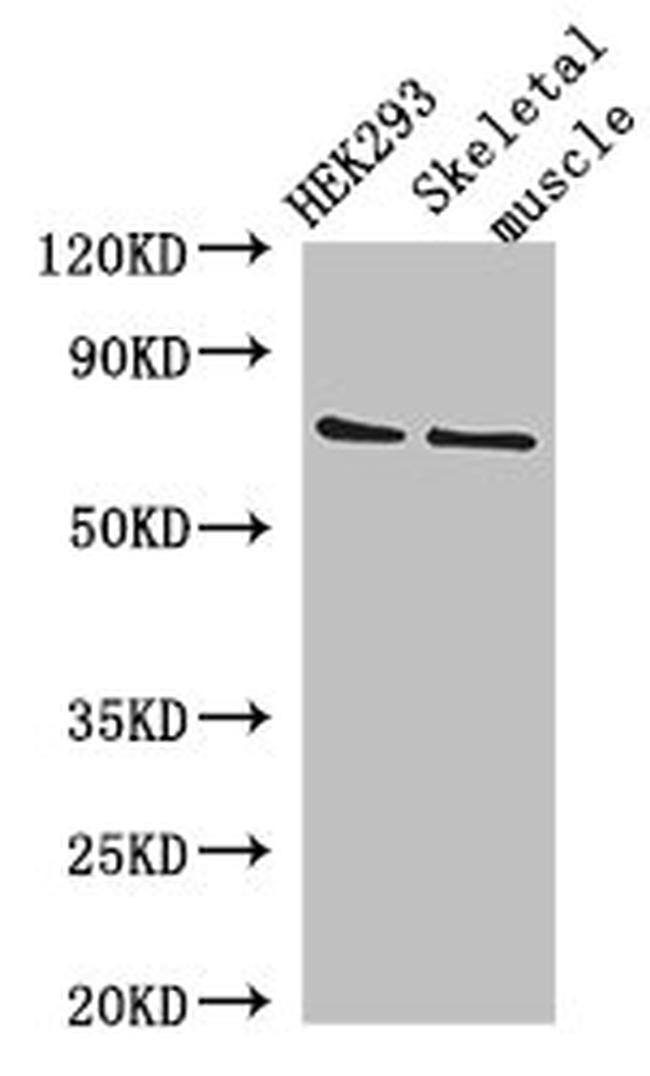 EFCAB7 Antibody in Western Blot (WB)