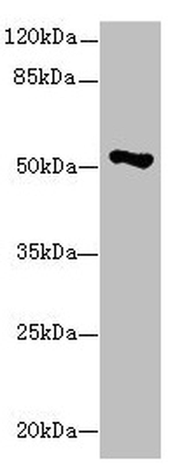 eIF2 gamma Antibody in Western Blot (WB)